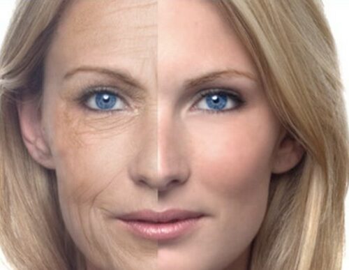 Prevenindo o envelhecimento da pele: o inimigo sol