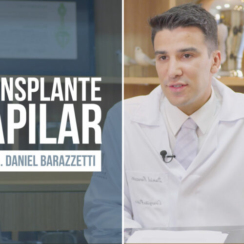 Transplante capilar – O que é, como funciona, para quem é recomendado?