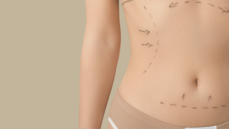 Elimine a gordurinha localizada com LipoTight sem cortes
