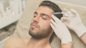 Toxina Botulínica Full Face: o protocolo completo para rejuvenescimento global da face